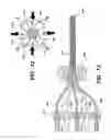 Fig. 06 - Exothermic Wire for Bonding Substrates