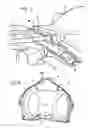 Fig. 03 - Disc brake, particularly for a commercial vehicle