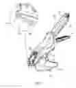 Fig. 11 - Palm size surgical stapler for single hand operation