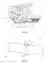 Fig. 24 - Palm size surgical stapler for single hand operation