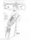 Fig. 02 - INTEGRAL TRIM TETHER SYSTEM FOR VEHICLE APPLICATIONS