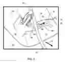 Fig. 06 - Pillar trim component