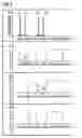 Fig. 05 - MR method for minimizing the chemical shift artifact, using a localized spatially dependent saturation pulse
