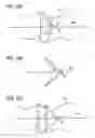 Fig. 13 - Image processing method and program for visualization of tubular tissue