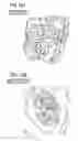 Fig. 15 - Image processing method and program for visualization of tubular tissue