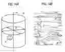 Fig. 17 - Image processing method and program for visualization of tubular tissue