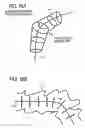 Fig. 20 - Image processing method and program for visualization of tubular tissue