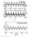 Fig. 09 - Circuit for detecting and measuring noise in semiconductor integrated circuit