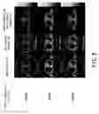 Fig. 07 - Radiodiagnostic apparatus