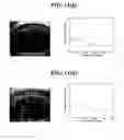 Fig. 09 - One-dimensional iris signature generation system and method