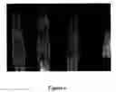 Fig. 03 - Methods and systems for analyzing bone conditions using mammography device