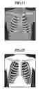 Fig. 04 - Image processing apparatus, image processing method and image processing program
