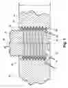 Fig. 02 - Tanged screw thread insert with improved removability