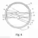 Fig. 05 - Device for the UV treatment of flowing fluids
