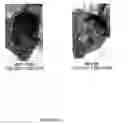 Fig. 03 - Prevention, decrease, and/or treatment of immunoreactivity by depleting and/or inactivating antigen presenting cells in the host