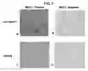 Fig. 08 - Methods for stimulating or enhancing proliferation of non-tumorous cells expressing MUC1 receptors