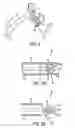 Fig. 04 - Apparatus for treating asthma using neurotoxin