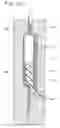 Fig. 10 - In-mold decorated molded product and method of manufacturing the same