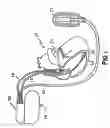 Fig. 02 - Welding methods and apparatus for batteries