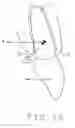 Fig. 02 - System and method for improved control of tooth movement with elastic repositioning appliances