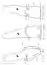 Fig. 07 - System and method for improved control of tooth movement with elastic repositioning appliances