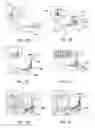 Fig. 02 - Method and system for fixing removable dentures