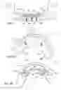 Fig. 04 - Method and system for fixing removable dentures