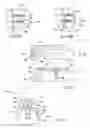 Fig. 05 - Method and system for fixing removable dentures