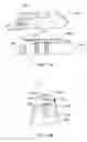 Fig. 09 - Method and system for fixing removable dentures