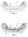 Fig. 02 - Method of making indirect bonding apparatus for orthodontic therapy