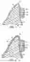 Fig. 03 - Method of making indirect bonding apparatus for orthodontic therapy