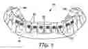 Fig. 04 - Method of making indirect bonding apparatus for orthodontic therapy
