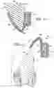 Fig. 05 - Method of making indirect bonding apparatus for orthodontic therapy
