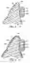 Fig. 06 - Method of making indirect bonding apparatus for orthodontic therapy