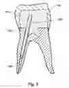 Fig. 09 - Kits for placement of a dental post
