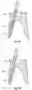Fig. 09 - Kit of sub-kits for placing a dental post