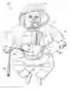 Fig. 01 - Peritoneal dialysis doll