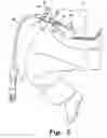 Fig. 03 - Peritoneal dialysis doll