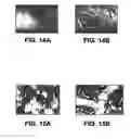 Fig. 11 - Therapeutic platelets and methods