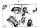 Fig. 20 - Methods for detecting endocrine cancer