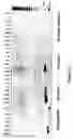 Fig. 03 - Methods, compositions, and kits for detecting nucleic acids in a single vessel