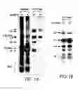 Fig. 06 - Assays for detecting small nuclear ribonucleoprotein particle assembly and survival of motor neurons activity
