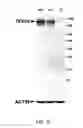 Fig. 05 - TEX14 compositions and modulators thereof to alter intercellular bridge development and function