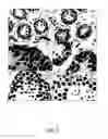Fig. 10 - TEX14 compositions and modulators thereof to alter intercellular bridge development and function