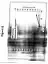 Fig. 13 - Use of a polypeptide for detecting, preventing or treating a pathological condition associated with a degenerative, neurological or autoimmune disease