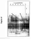 Fig. 15 - Use of a polypeptide for detecting, preventing or treating a pathological condition associated with a degenerative, neurological or autoimmune disease