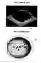 Fig. 02 - Chemical mechanical polishing method for manufacturing semiconductor device