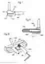 Fig. 04 - Weighting system for a putter type golf club