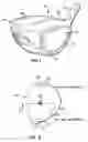 Fig. 02 - Golf driver having titanium alloy head and flexible shaft