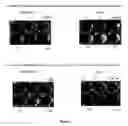 Fig. 03 - Compositions and methods for treatment of cancer